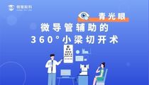 微導管輔助的360°小梁切開(kāi)術(shù)